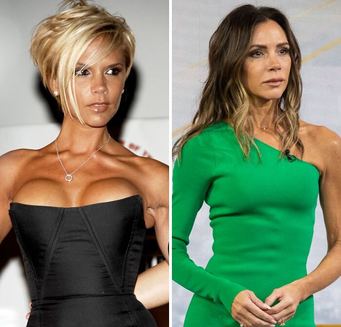 20 Celebs Had Their Breast Implants Removed