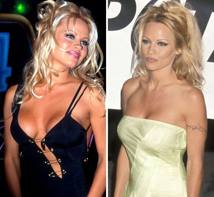 20 Celebs Had Their Breast Implants Removed