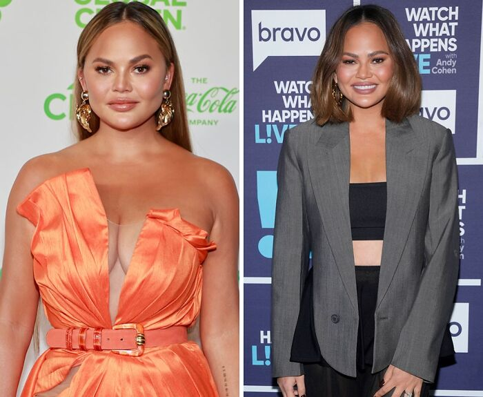 20 Celebs Had Their Breast Implants Removed