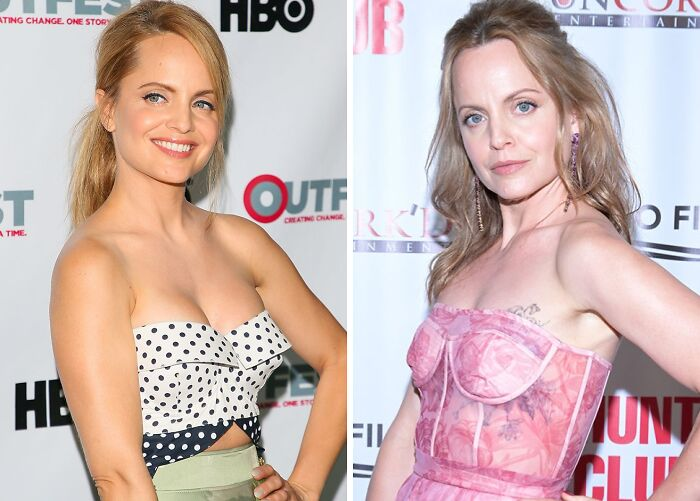 20 Celebs Had Their Breast Implants Removed