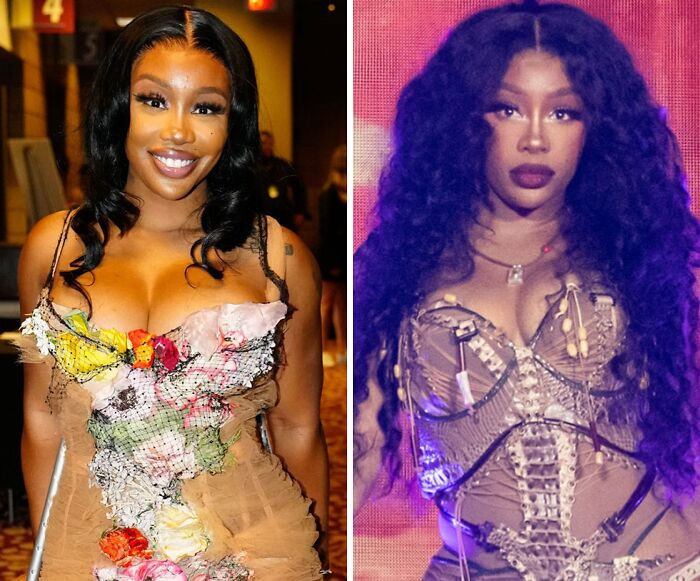 20 Celebs Had Their Breast Implants Removed