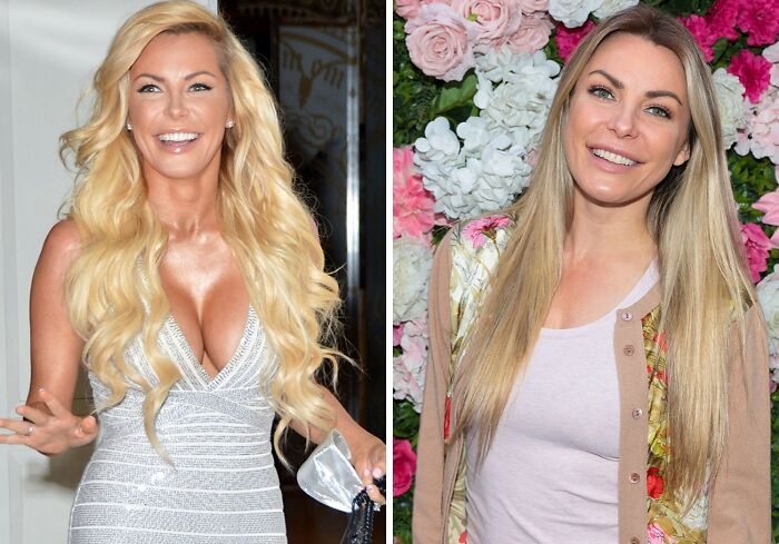 20 Celebs Had Their Breast Implants Removed