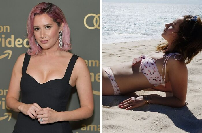 20 Celebs Had Their Breast Implants Removed