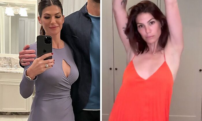 20 Celebs Had Their Breast Implants Removed