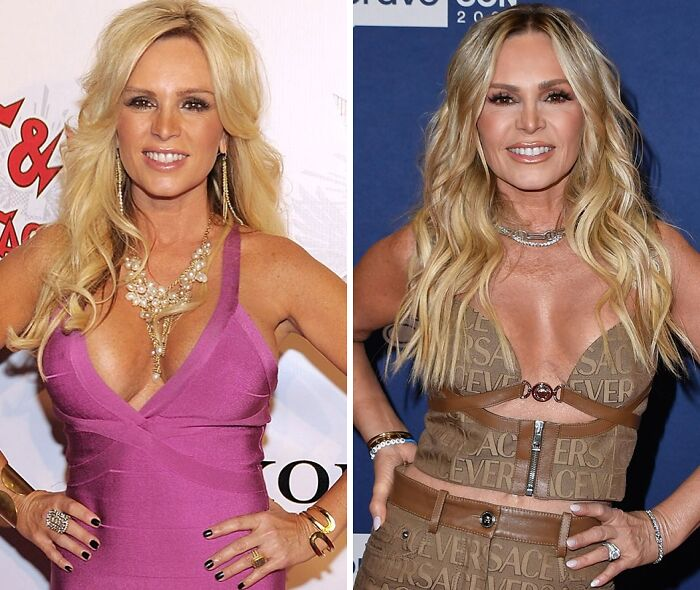 20 Celebs Had Their Breast Implants Removed