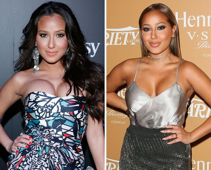 20 Celebs Had Their Breast Implants Removed