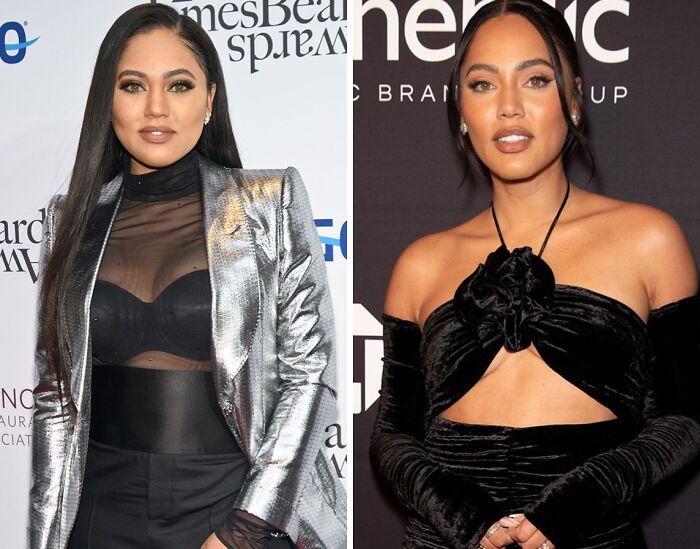 20 Celebs Had Their Breast Implants Removed
