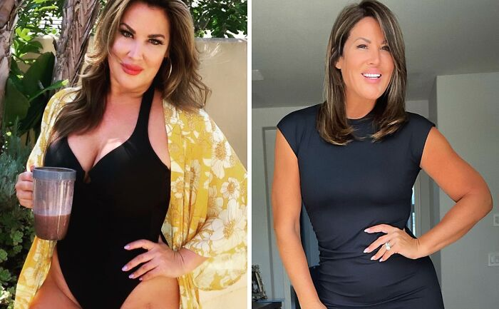 20 Celebs Had Their Breast Implants Removed