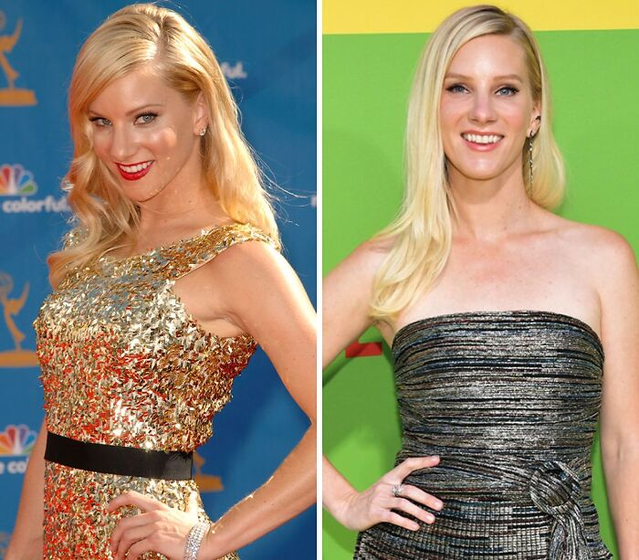20 Celebs Had Their Breast Implants Removed
